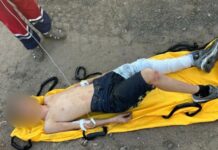 Под Одессой двое подростков забрались на крышу вагона ради фото и получили серьезные ожоги